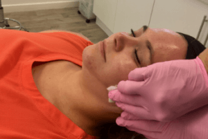 a client receiving a chemical peel skin peel