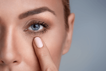 a lady pointing to her tear troughs for dermal fillers