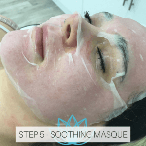 microneedling treatment